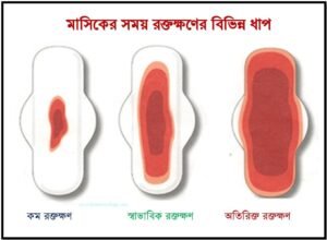 নিয়মিত ও অনিয়মিত মাসিক